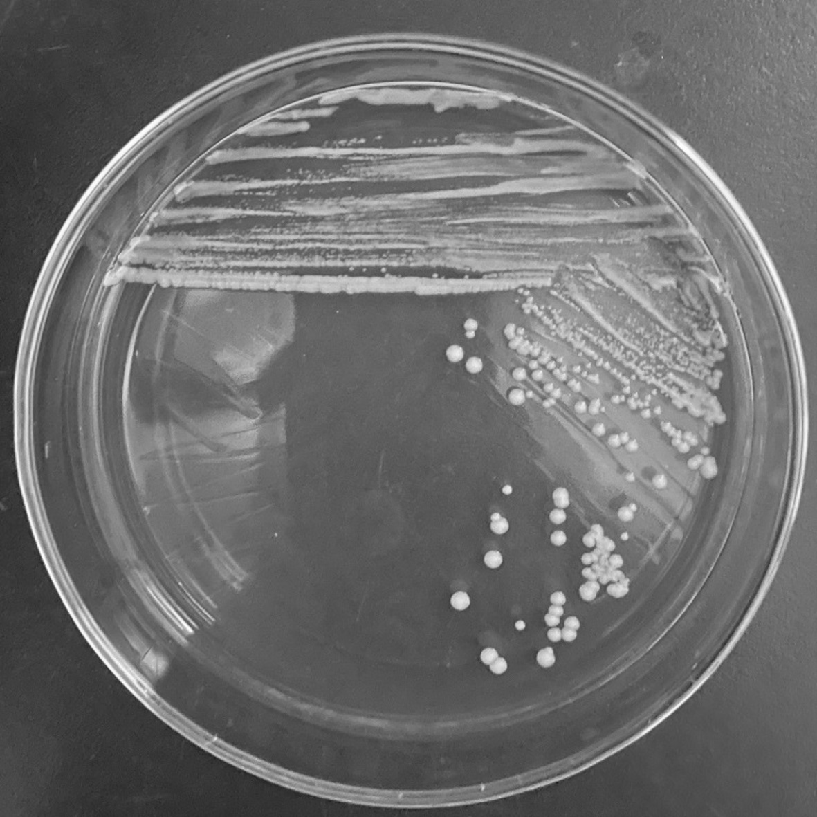 一种白假丝酵母菌及其在发酵饲料中的应用