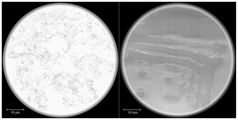 一株大豆根瘤菌及其应用-爱企查