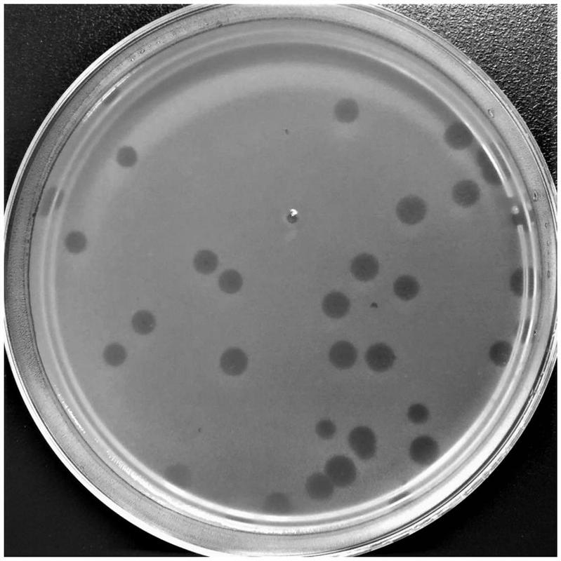 一种地毯草黄单胞菌噬菌体及其组合物,试剂盒和应用