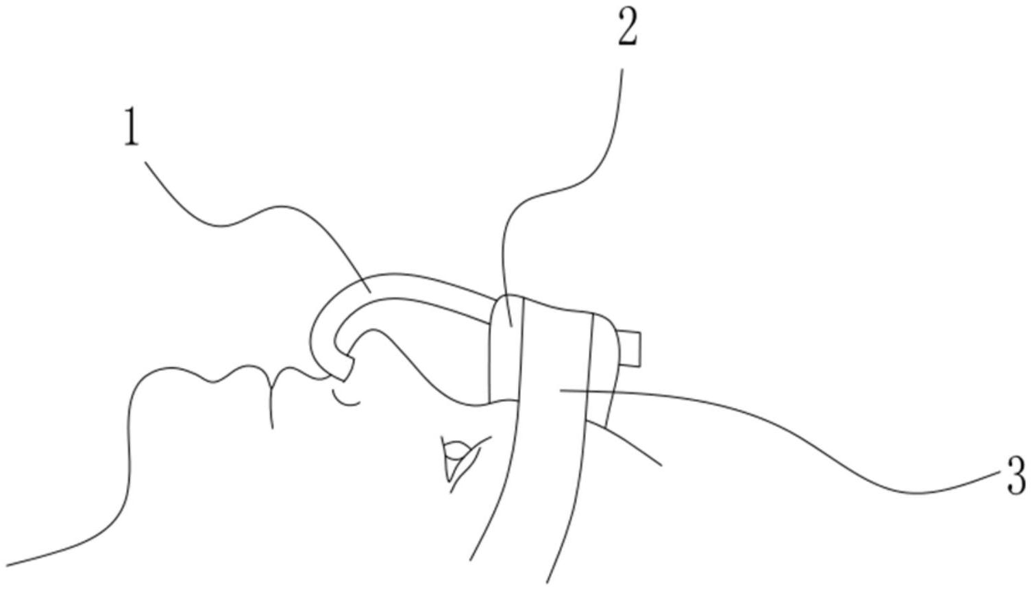 一种经鼻气管导管的固定结构-爱企查
