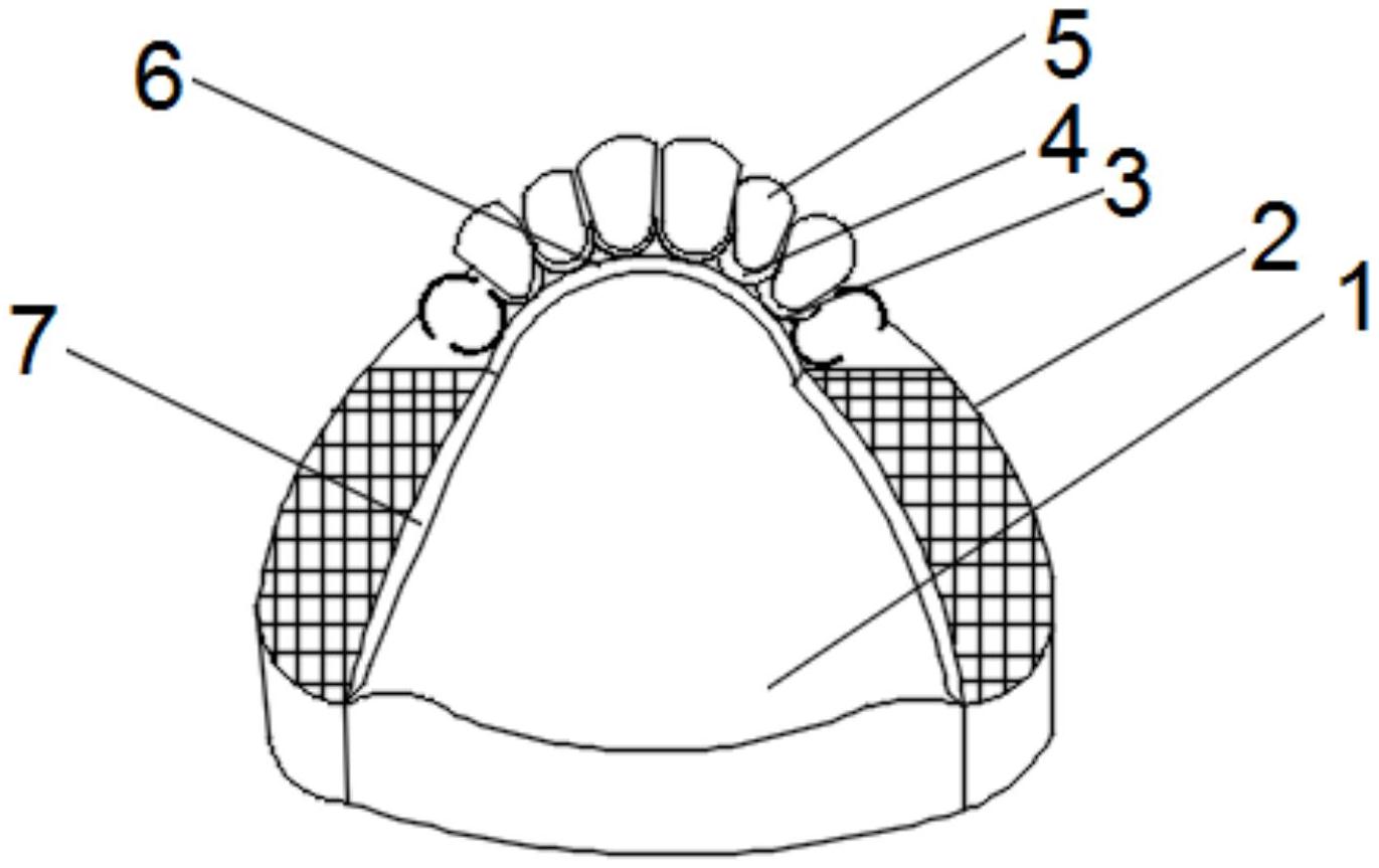 一種佩戴穩定的數字化活動義齒支架-愛企查