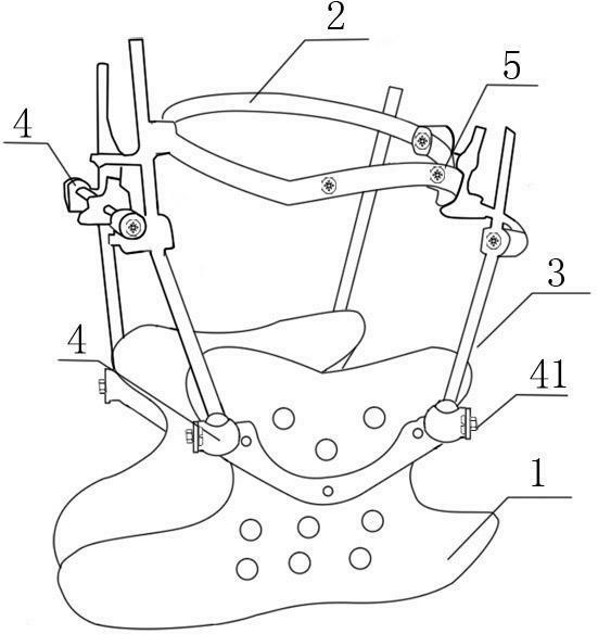 改良halo架及其用于辅助下颈椎单侧关节突交锁复位的方法-爱企查