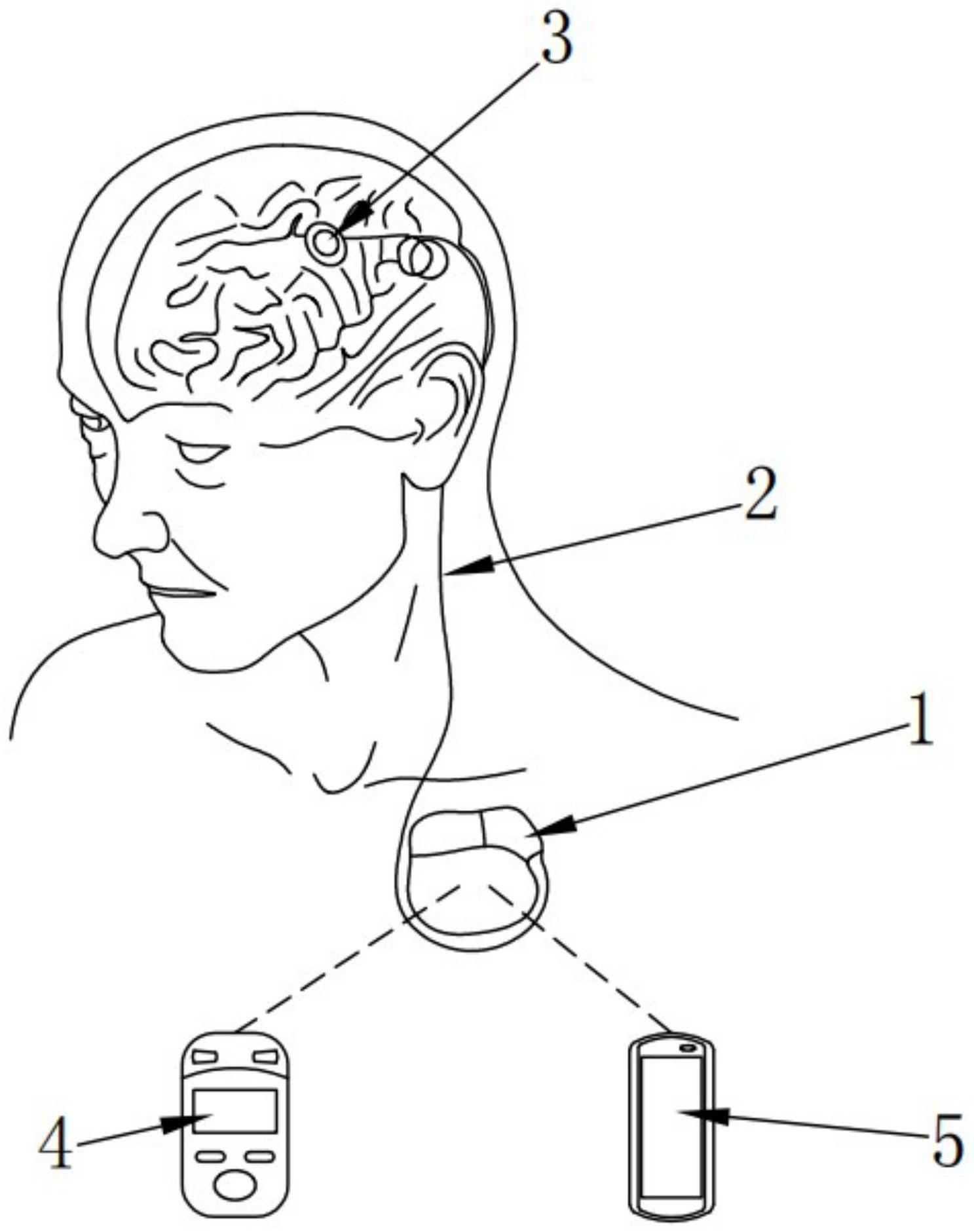 一种基于dbs技术的帕金森病治疗装置及其应用方法-爱企查