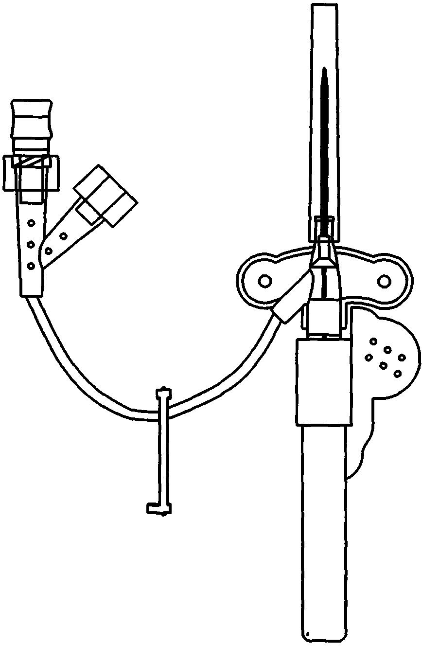 带翼安全型留置针-爱企查